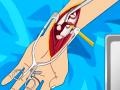                                                                       Arm surgery 2 ﻞﯿﮭﮐ